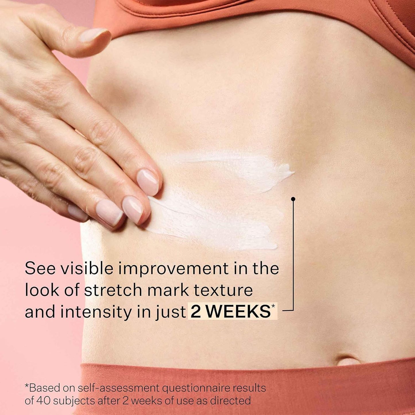 StriVectin SD Advanced Plus - Intensive Moisturizer for Wrinkles & Stretch Marks | Collagen Boosting with Peptides & Hyaluronic Acid