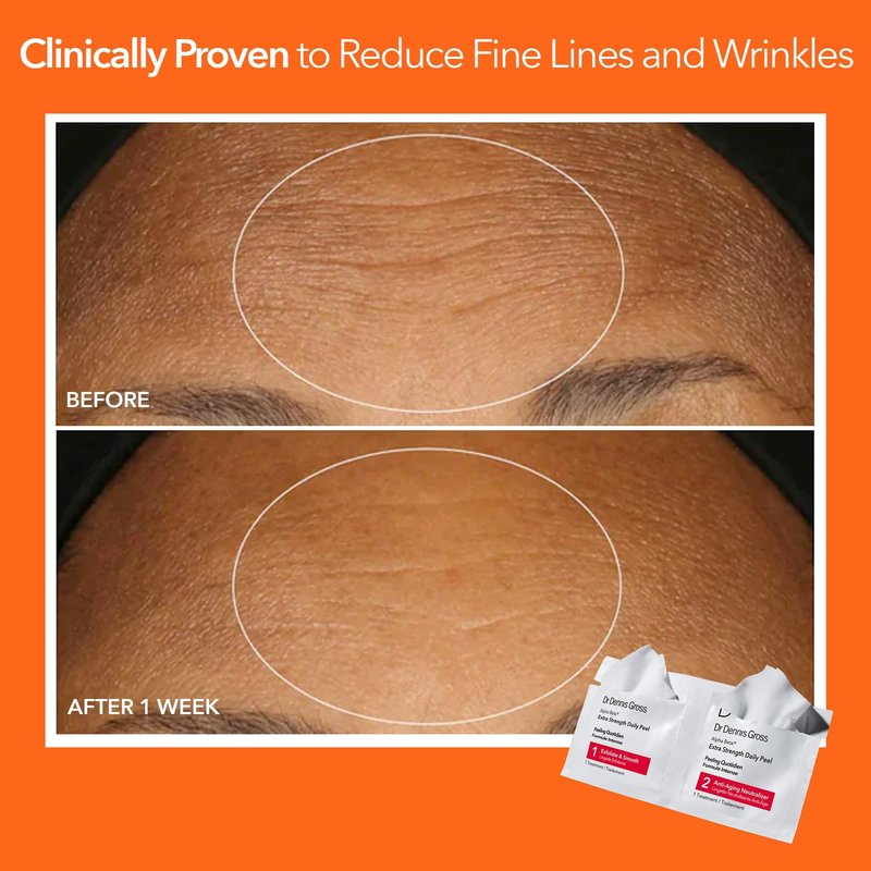 Dr. Dennis Gross Alpha Beta Extra Strength Daily Peel – 2-Step Exfoliating Pads for Enhanced Anti-Aging, Smoother Skin, and Radiant Complexion