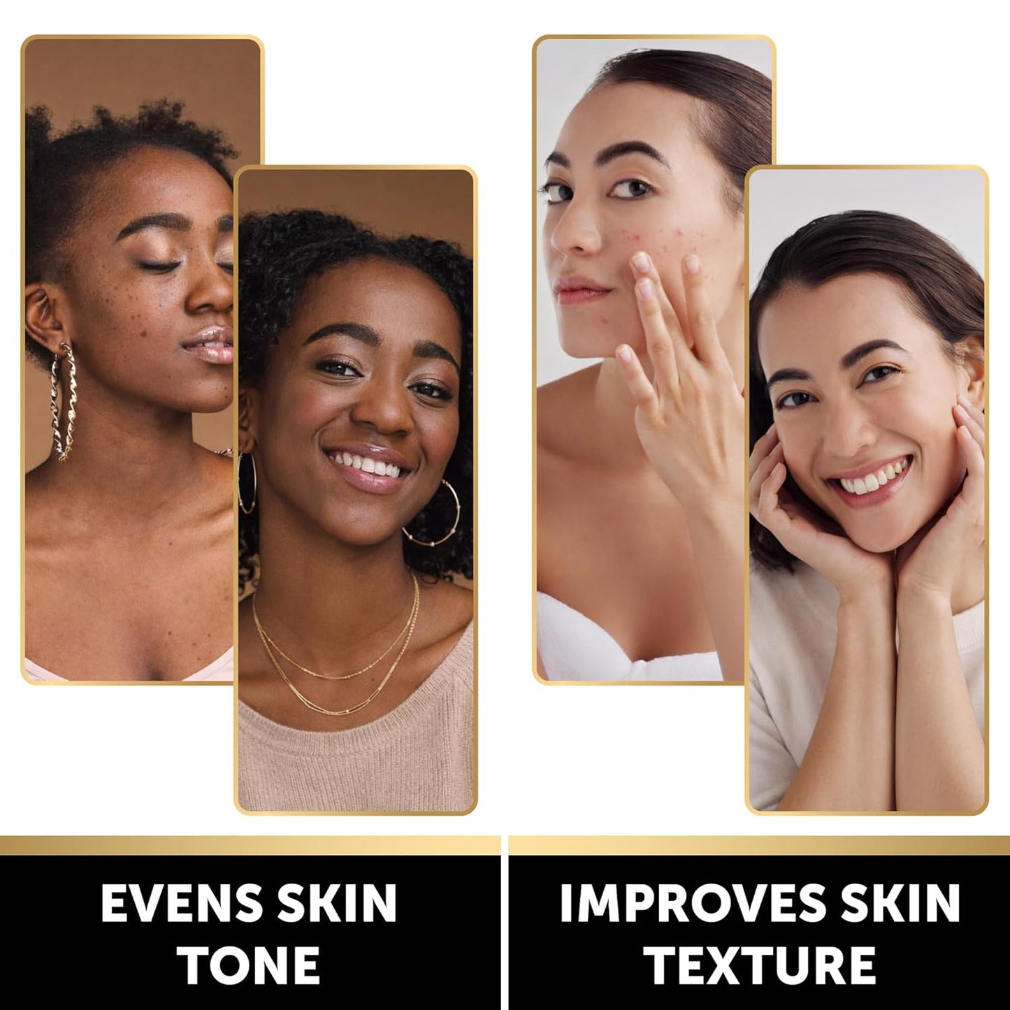 Brightening Kojic Acid Soap with Lemon & Turmeric - Dark Spot Corrector | 5 Pack with Vitamin C & Hyaluronic Acid