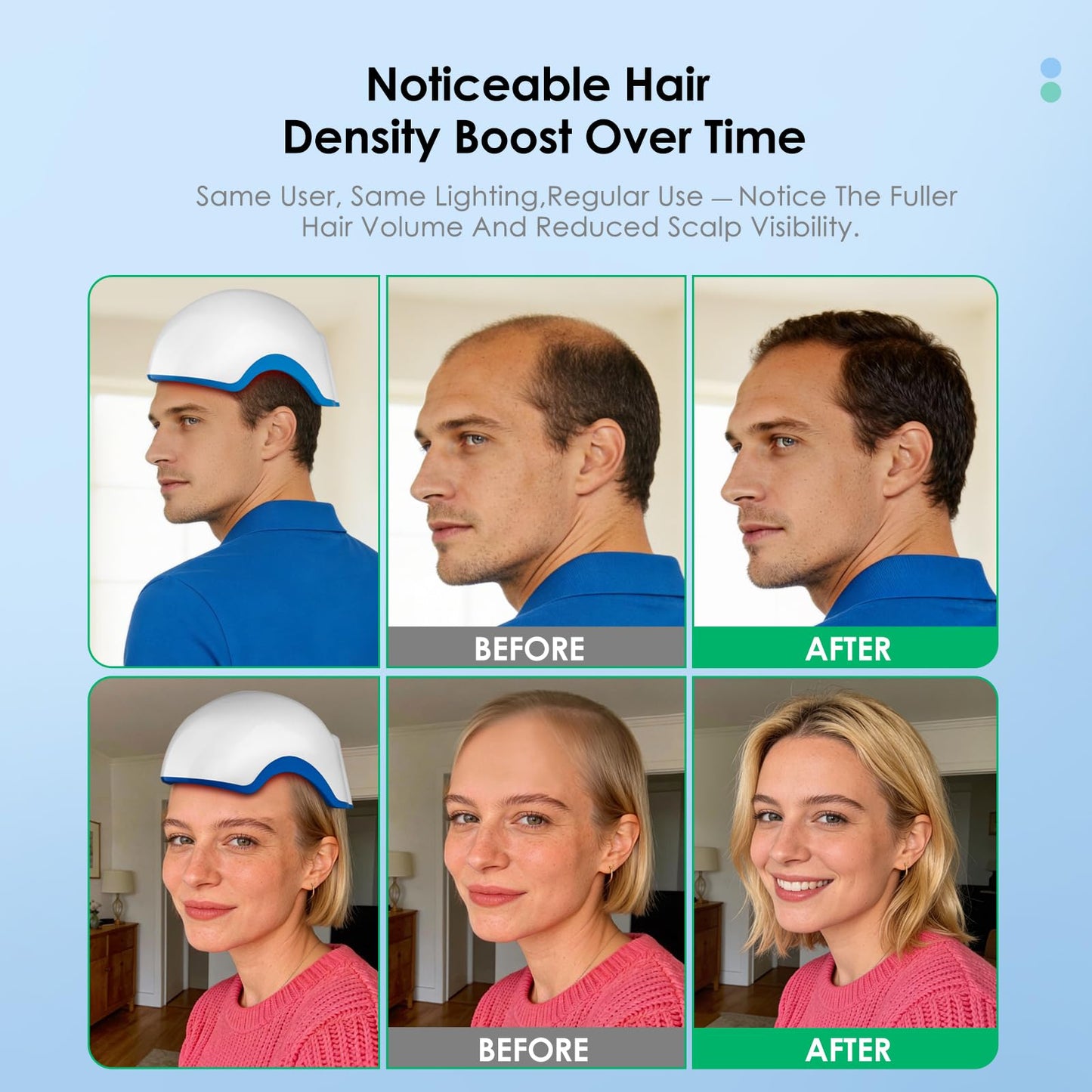 Red Light Therapy for Hair Growth Device, Laser Cap for Hair Regrowth, FDA Therapy Hair Loss Treatment System