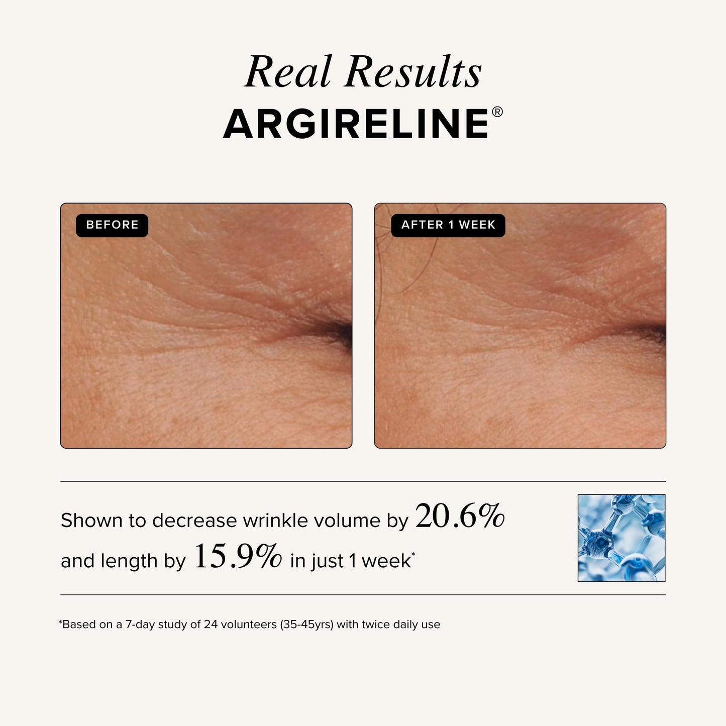 Asterwood Matrixyl 3000 + Argireline Serum with Hyaluronic Acid - Anti-Aging, Wrinkle Reducing, Collagen Boosting - Fragrance-Free - 2 Fl Oz
