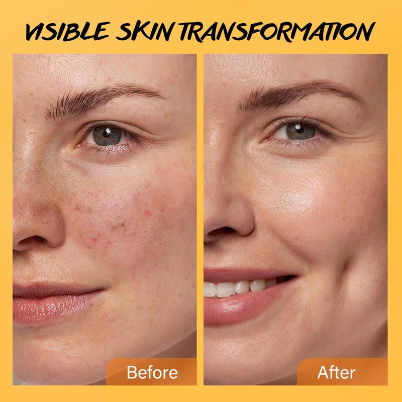 Exfoliating Face Scrub with Turmeric and Vitamin C Face Exfoliator Scrub Powder for Exfoliation Dullness Acne Blackheads Oiliness Exfoliating Face Wash for Women Clean Moisturizes Soothes Amino Acid