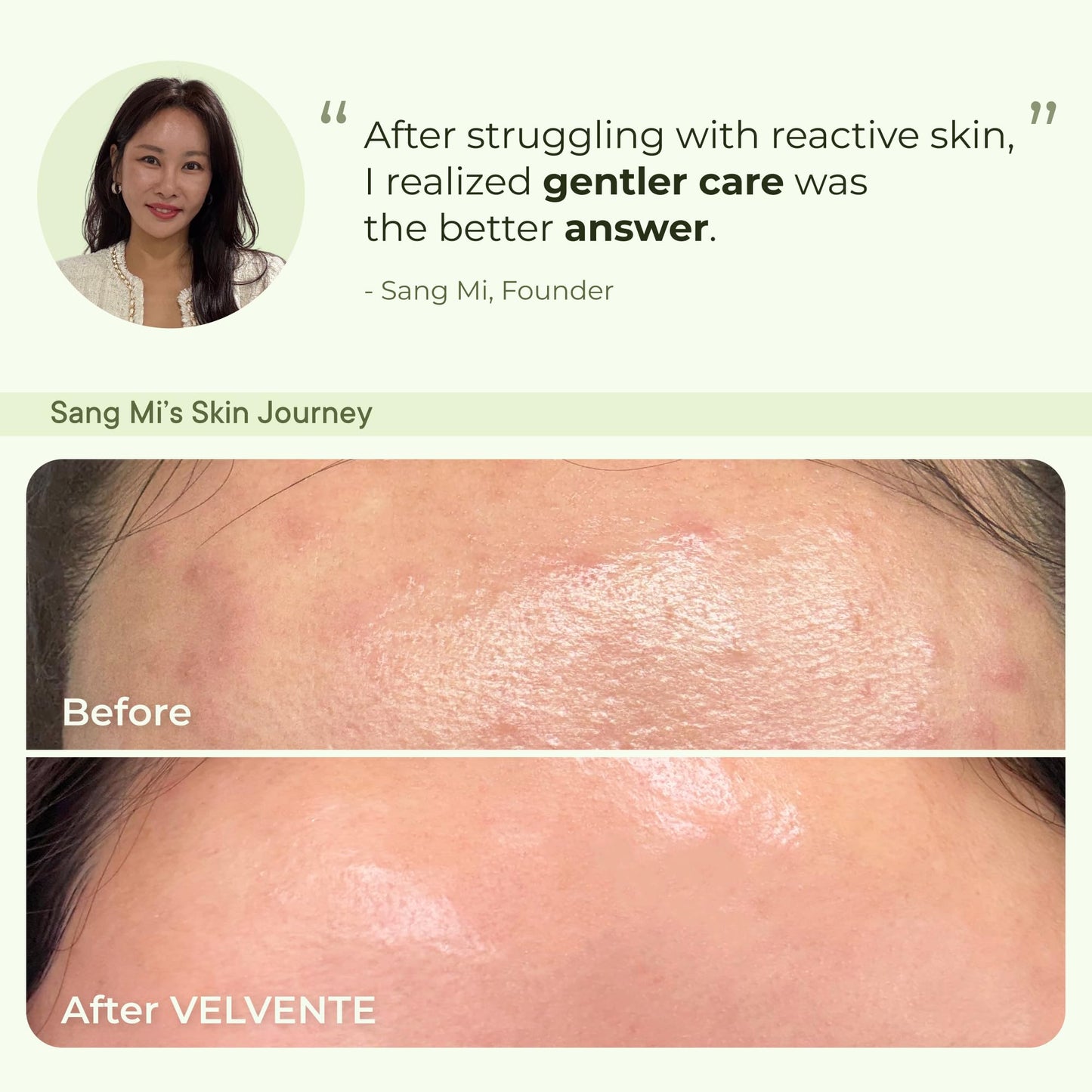 VELVENTE Matcha PDRN Korean Cleanser & Face Wash, Acne-Prone Sensitive Skin