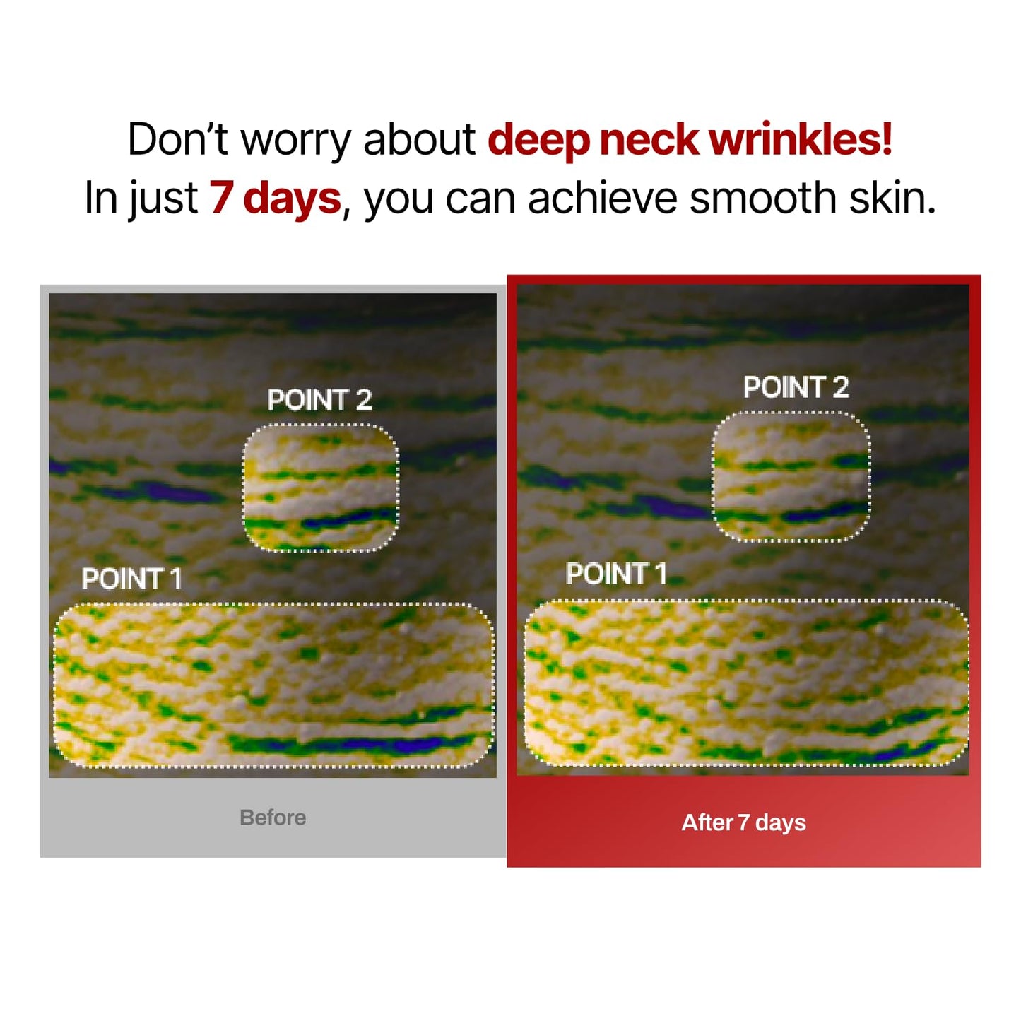 MEDITHERAPY Wrinkle-fit Face Mask & Wrinkle-fit Neck Mask + Facial Roller - Neck Wrinkle Patches, Neck Firming and Tightening Korean Deep Collagen Mask - Mesh Sheet Mask for Lifting Sagging Skin