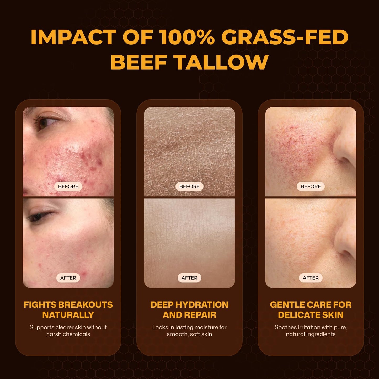 VIORY Tallow and Honey Balm for Face, Beef Tallow for Skin, Moisturizer with 100% Organic Grass-Fed Beef Tallow & Raw Wild Honey - Natural Formula for Dry & Sensitive Skin (Unscented)