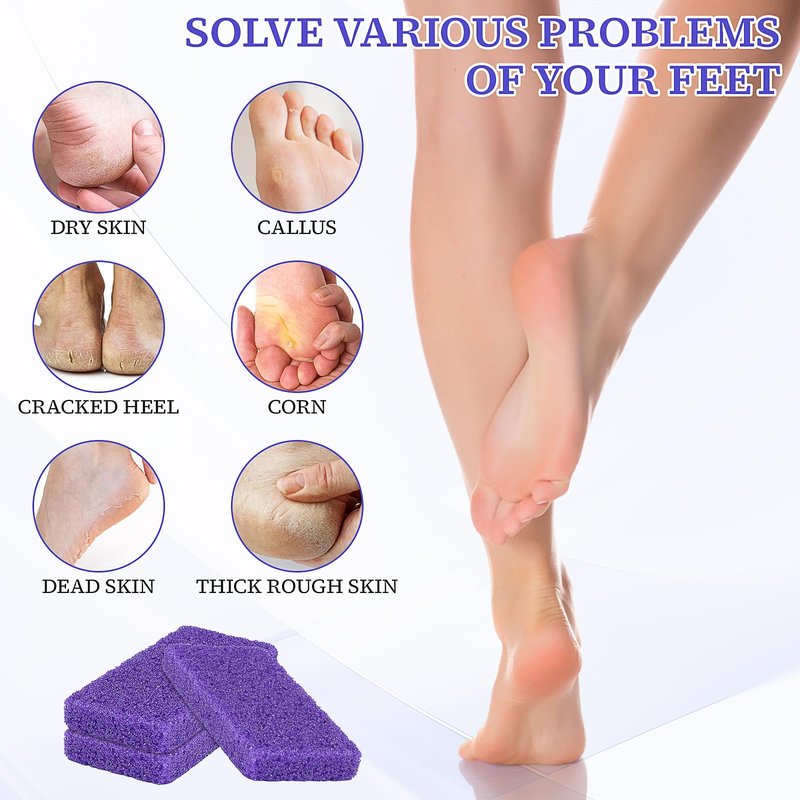200 Pcs Pumice Stone Bulk for Feet Scrubber,Dead Skin Disposable Foot Pumice Foot Callus Remover Pedicure Tools Purple Pumice Sponge Nail Salon Home Use