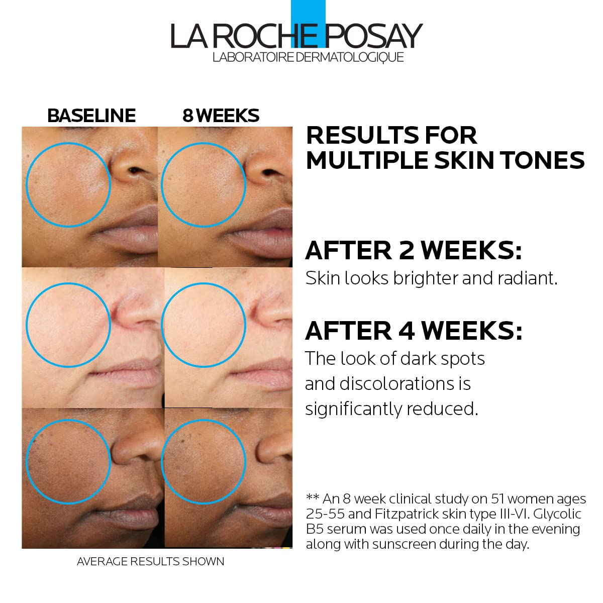 La Roche-Posay Glycolic Acid Serum - Brightening Skin Tone Corrector with Tranexamic & Kojic Acid | Reduces Dark Spots