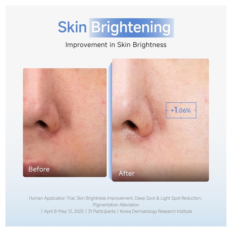 Korean Brightening Cream Face Mask - Dark Spot Correcting & Hydrating | 5 Sheets, Gentle for Sensitive Skin