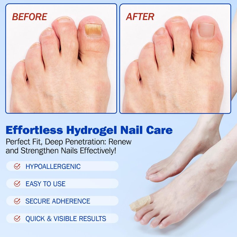 Nail Patches 42PCS, Multi-Purpose for Thick, Cracked & Discoloured Nails, Long-Lasting 8-Hour Repair, Nail Care