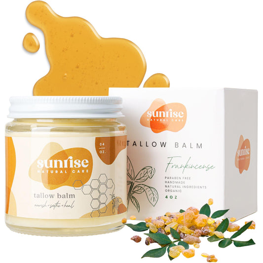 Sunrise Natural Care Unwhipped Honey and Tallow Balm - Body and Face Moisturizer - 100% Grass Fed Beef Tallow - 4 ounces - Frankincense
