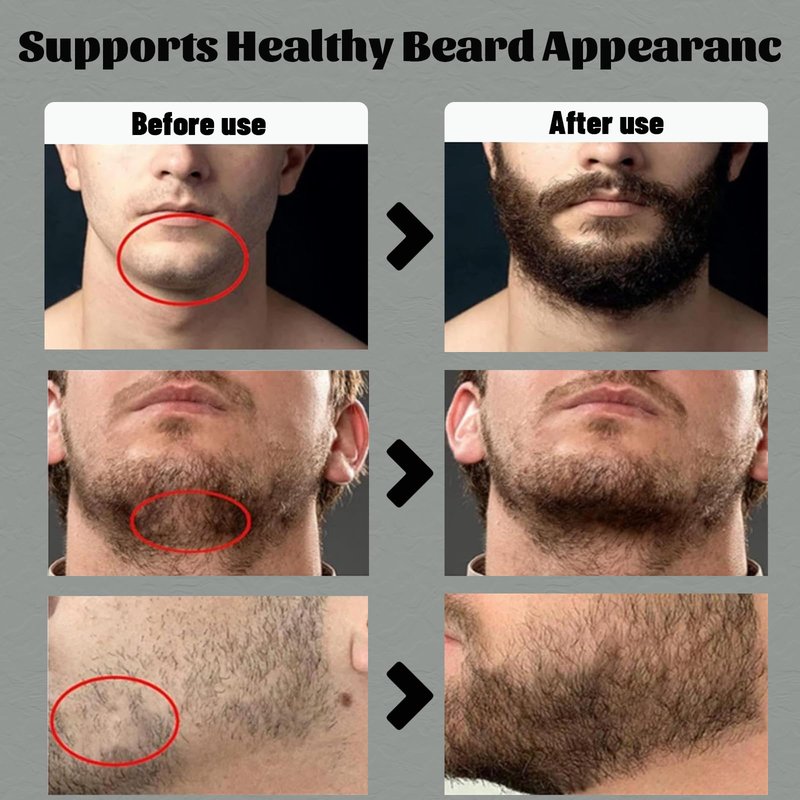Para Barba, Shea Moisture Beard Balm for Men, Crecimiento De Barba Para Hombre, Beard Growth Vitamins, Estimulante De Barba Ultra Potente, Strengthens Barba for Mens (2PCS)