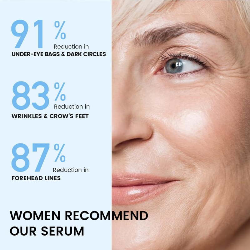 RONKIE Instant Eye Face Lift Cream: Reduces Eye Bags Wrinkles Puffy Eyes Dark Circles Crow’s Feet in Minutes for Mature Skin of Middle-aged Women 1 Fl Oz