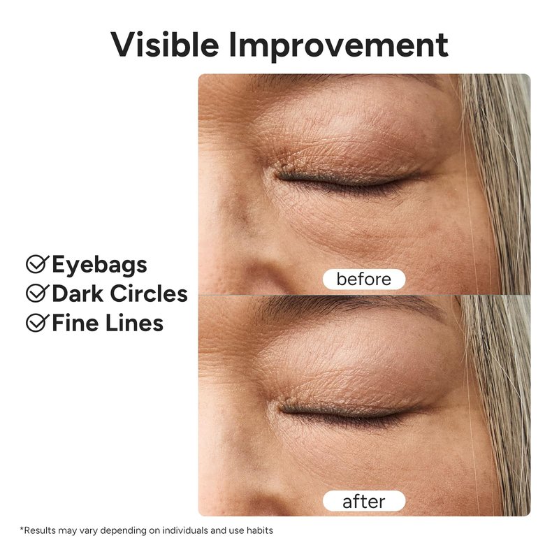 In My Eyes Eye Repair Gel Cream - Under Eye Cream with Caffeine & Lutein, Anti-Wrinkle and Firming, Treatment to Reduce Dark Circles, Fine Lines & Puffiness, 0.5 oz.
