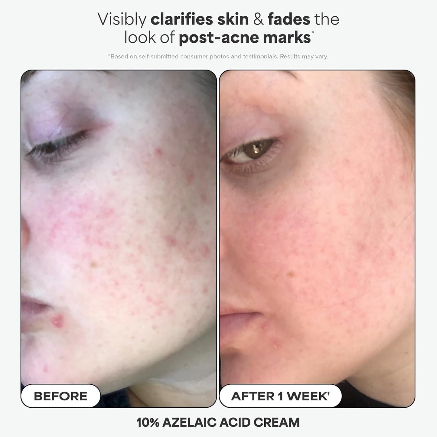 Paula's Choice Complexion Clarity Kit - 2% BHA Exfoliant & 1% Retinol Treatment | 3-Piece Skin Care Set for Clear, Glowing Skin