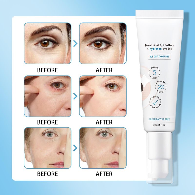 LUIMOLL Restore Eyelid Cream, 3% Oat Extract & Ceramide Complex, Soothing Hydration & Barrier Support for Dry, Itchy, Red, Sensitive, or Flaky Skin Around the Eyes for All-Day Use, 1oz