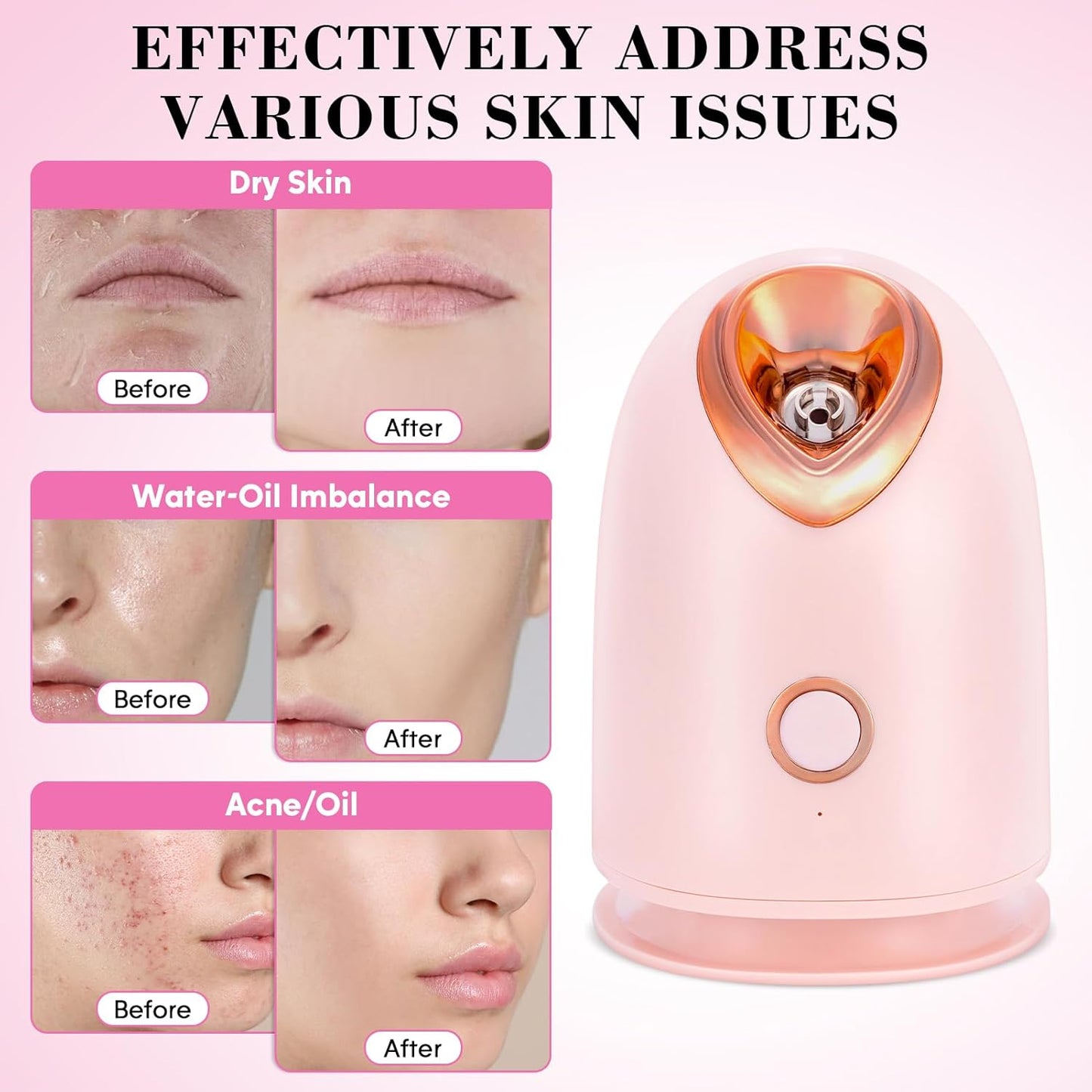 Pjordo Face Steamer - Nano Ionic Facial Deep Cleaning Humidifier | Home Spa with Bonus 4-Piece Skin Kit