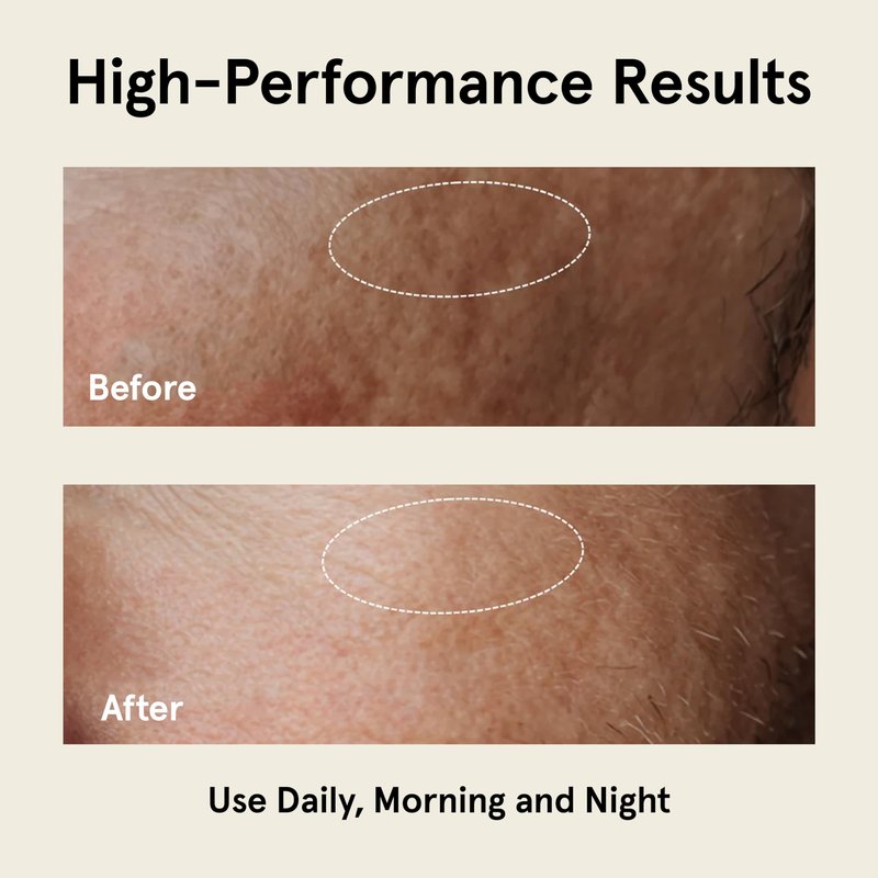 JAXON LANE RELAX AND REPAIR Anti Aging Face Moisturizer for Men | Anti Wrinkle Cream for Face, Night Cream, Eye Cream with Niacinamide (Vitamin B3), Hyaluronic Acid, Vitamin E & Ceramides For Skin