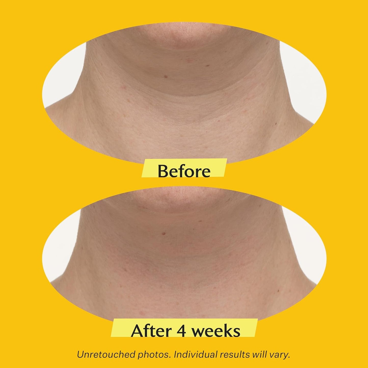StriVectin Tighten and Lift Neck Cream - Firming & Tightening Formula for Smooth, Youthful Skin | 0.25 oz