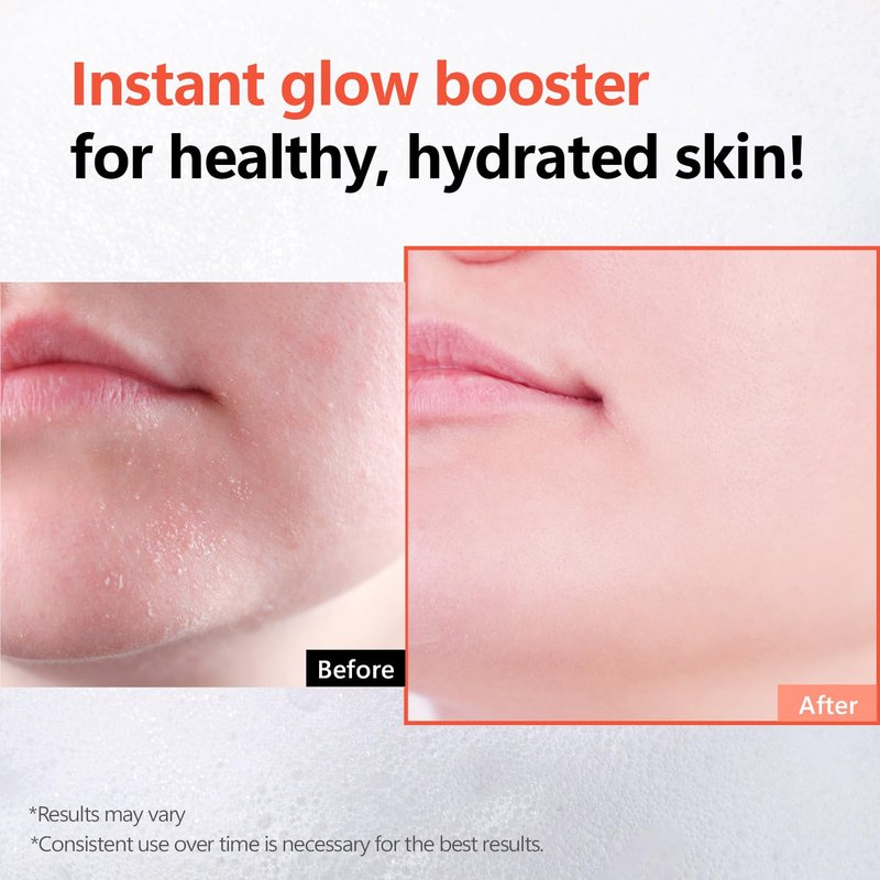 Rice Glow Bubble Toner 5.07 fl oz - Milky Toner for Sensitive and Dry Skin, with Niacinamide and Rice Extract for Deep Hydration, Glowing Skin, Korean Skincare