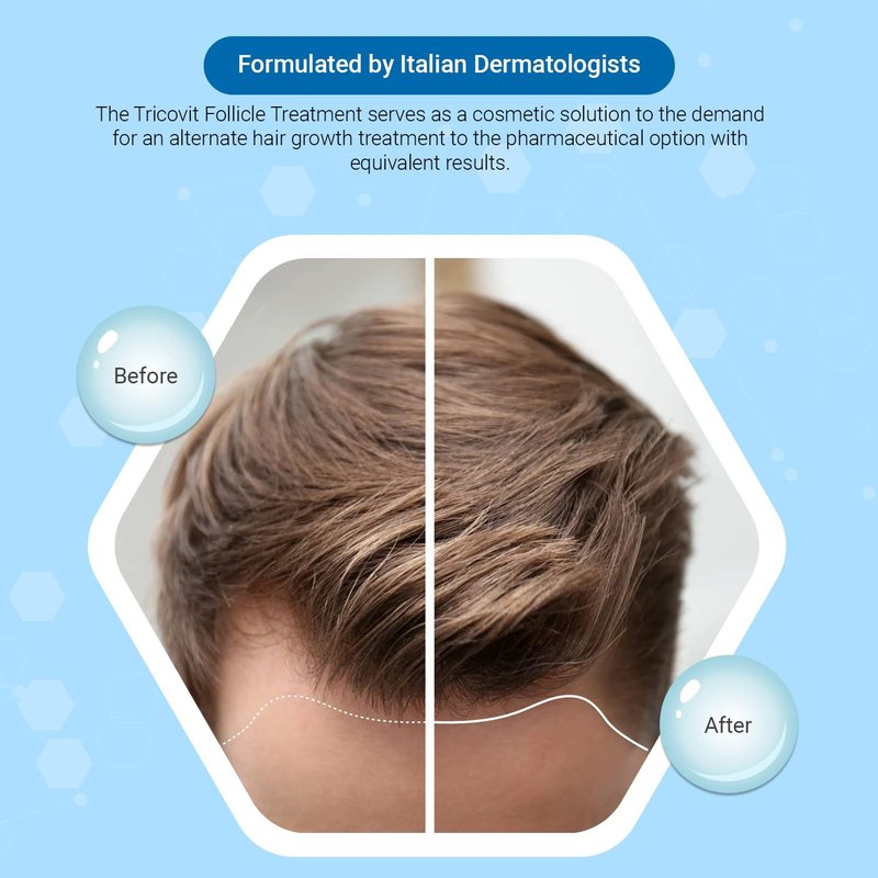 Tricovit Forte Hair Loss Treatment - Hair Growth Products for Women & Men - Sebum Regulator for Strengthening Follicles & Balancing Scalp (5ct)