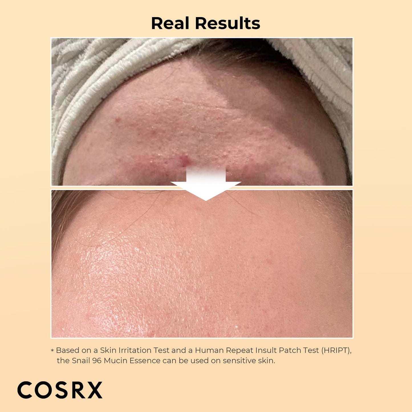 COSRX Snail Mucin Duo - Snail 92 Cream & Snail 96 Essence, Daily Face Gel Moisturizer and Hydrating Serum for Face with Snail Secretion Filtrate, Korean Skin Care