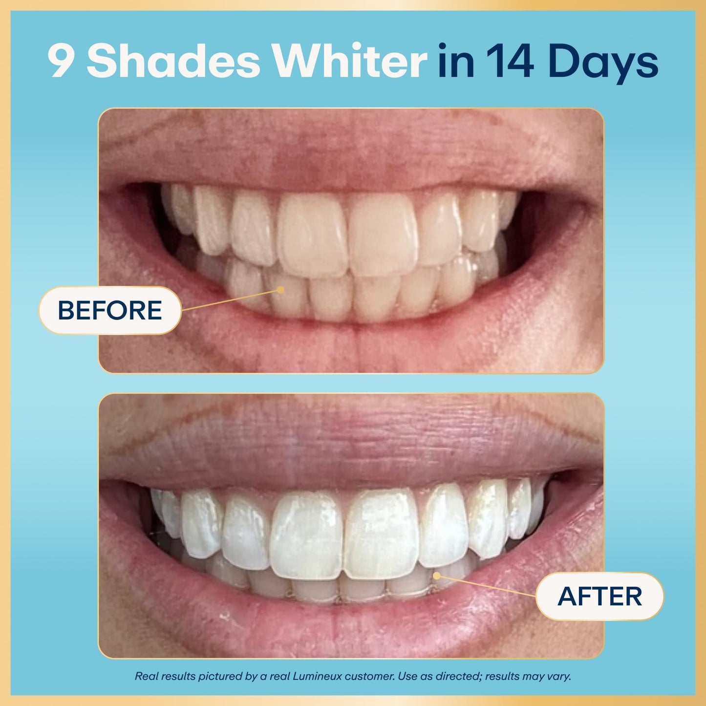 Lumineux Teeth Whitening Strips, Peroxide Free, 9 Treatments (1 Month)