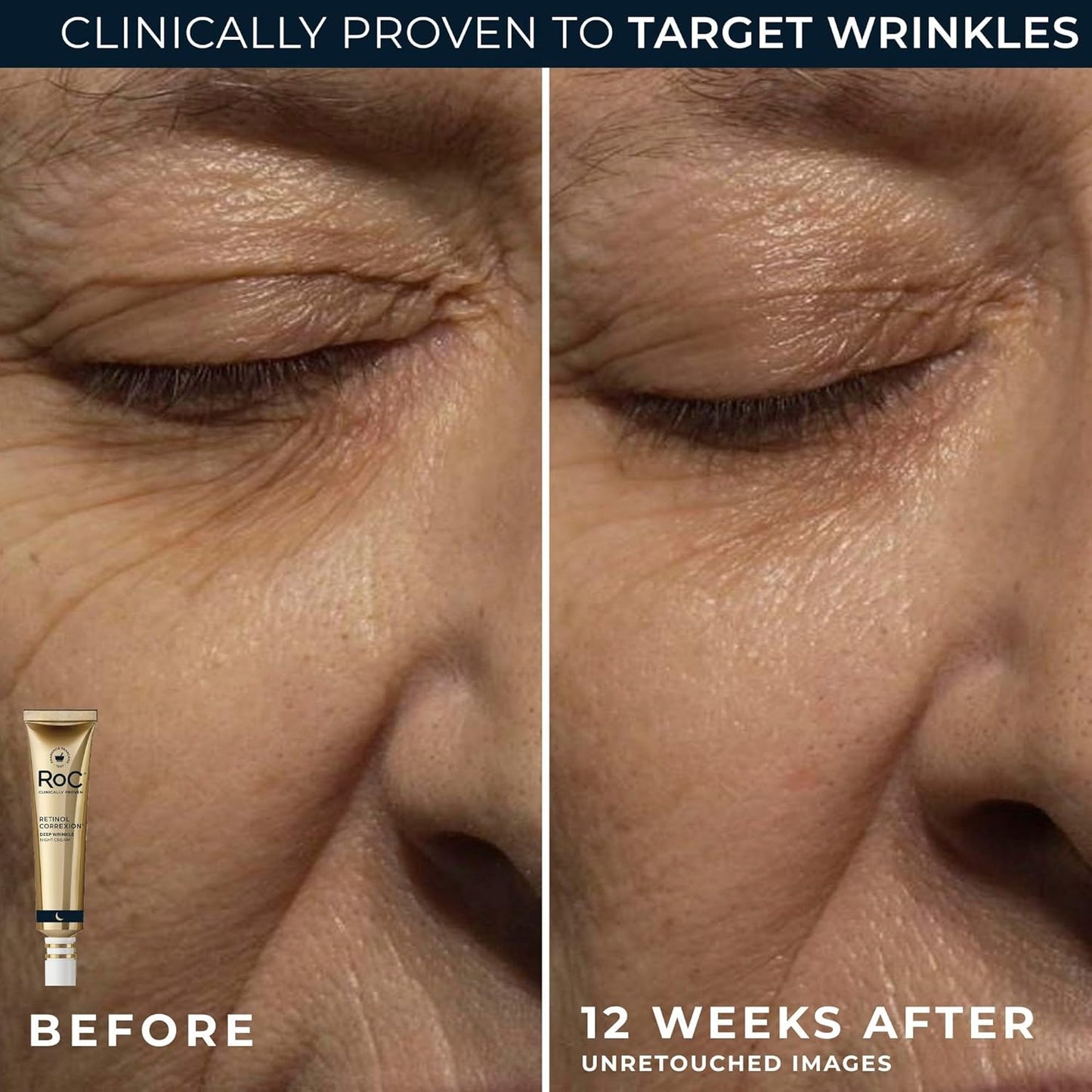 RoC Retinol Correxion Duo Set | Deep Wrinkle Night Cream & Under Eye Treatment for Dark Circles
