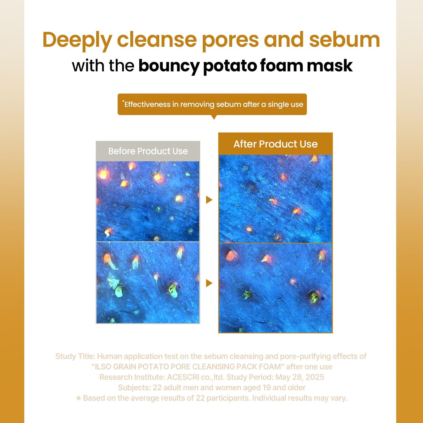ilso Grain Potato Pore Cleansing Pack Foam, Deep Cleansing Mask for Acne-Prone Skin, with Totarol, Pore Cleanzyme, Daily Exfoliating Cleanser, Korean cleanser, 5.07 fl. oz.