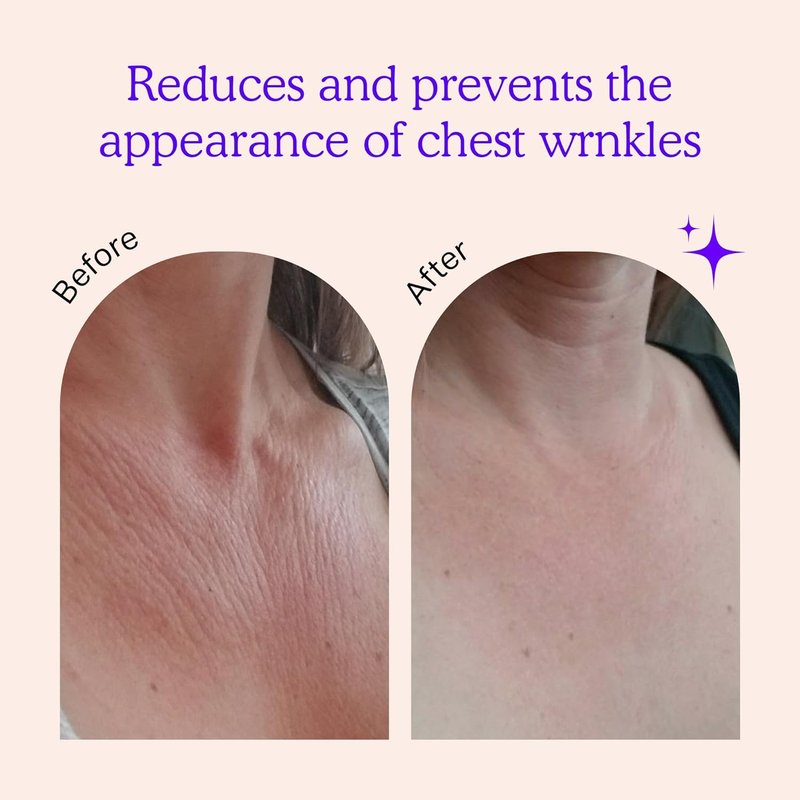 BLUMBODY Chest Wrinkle Pads - Anti-Wrinkle Silicone Patches for Firming & Smoothing | Reusable Overnight Neck & Décolleté Care (1-Month Supply)