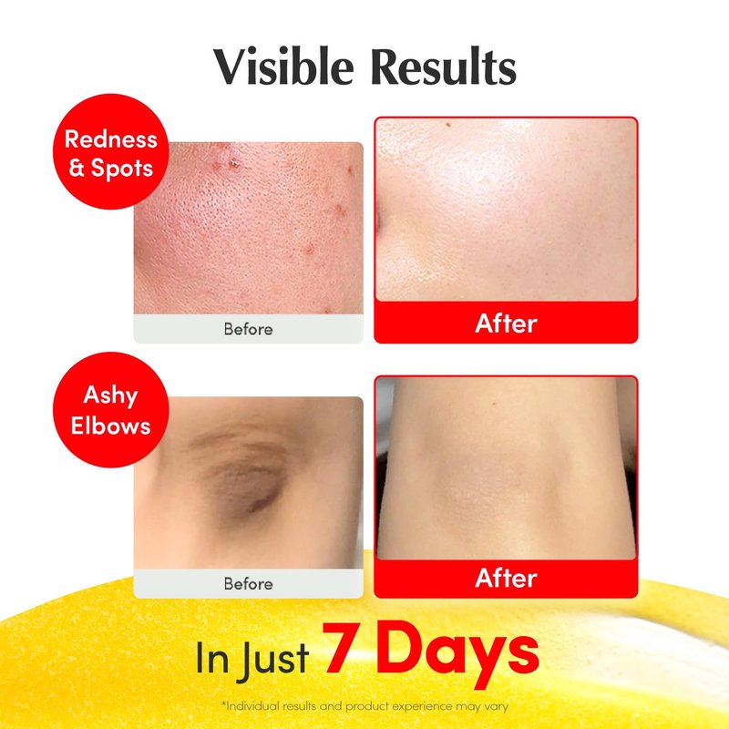 Vitamin C Face Glow Serum - Niacinamide 4% & Hyaluronic Acid for Dark Spots | Korean Skincare, 1.01 fl. oz