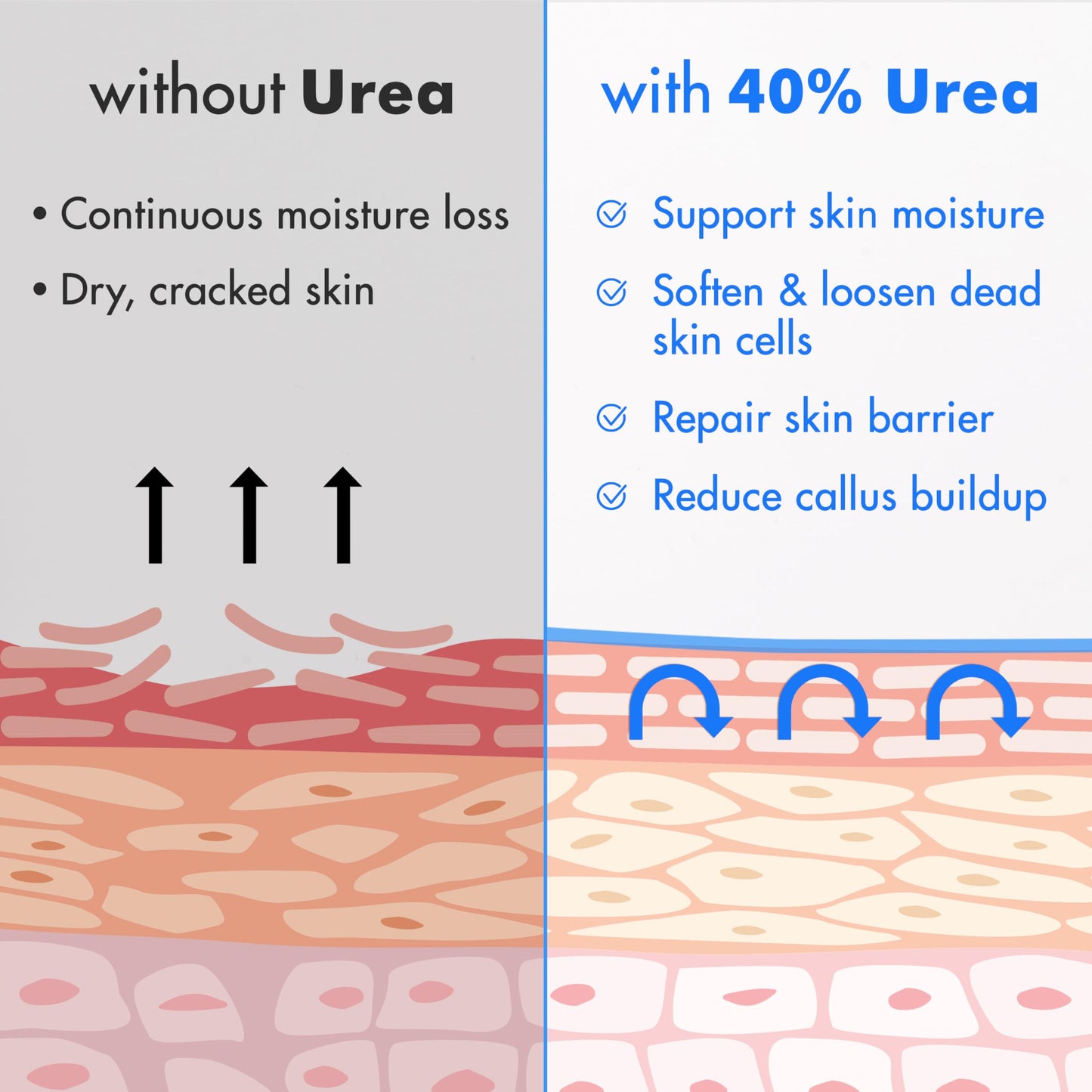 Ebanel Urea Cream 40% plus Salicylic Acid 2% for Dry Cracked Feet Skin