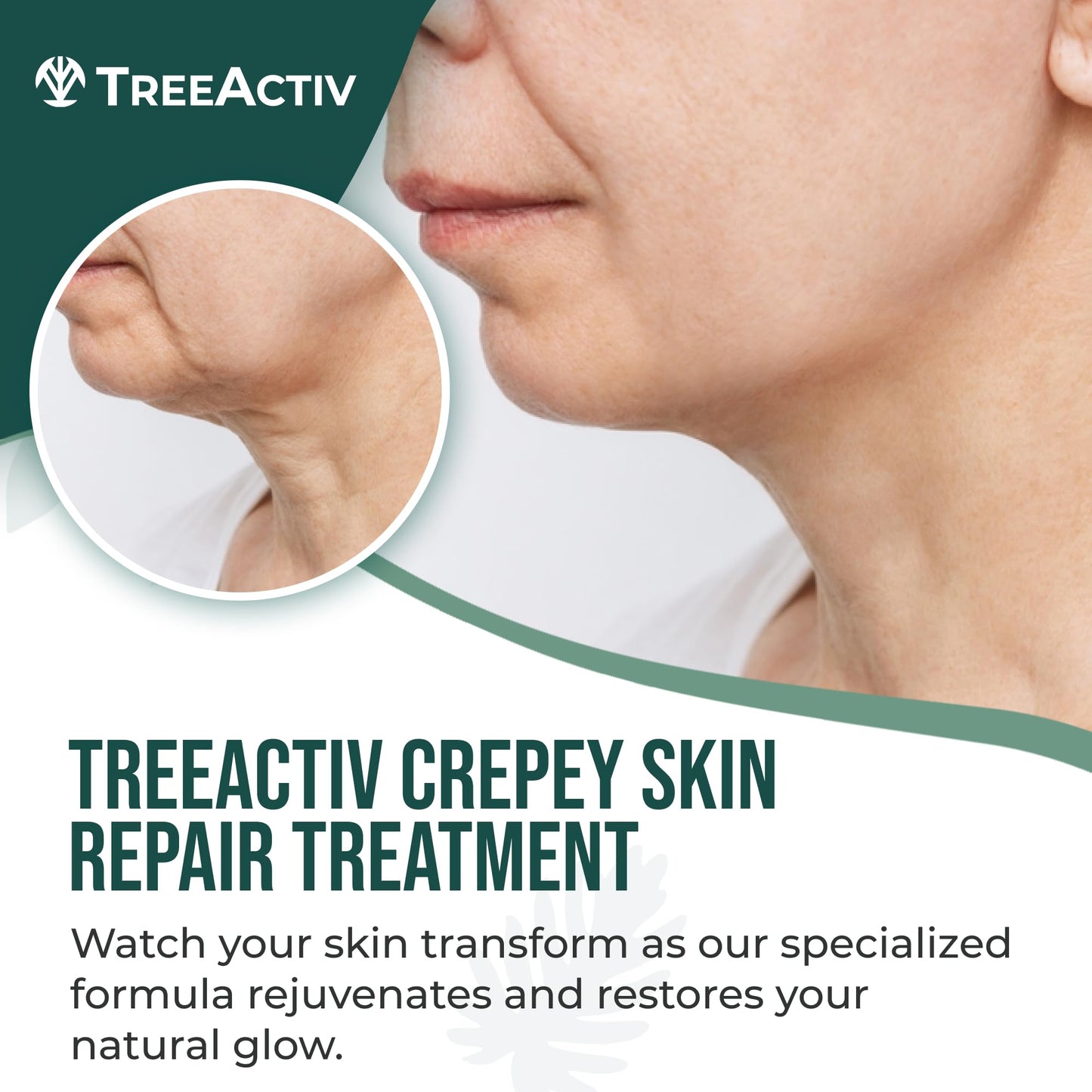 TreeActiv Crepey Skin Repair Cream Original Formula, 8 fl oz, Firming Cream For Face & Neck, Skin Firming Lotion with Hyaluronic Acid, Crepey to Address Dry Crepe