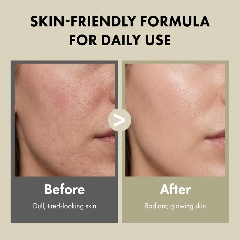 TWENTY KEI Vitamin Serum for Face, Korean Brightening Serum for Dull-Looking Skin, Lightweight Glow Serum for Radiance & Even-Looking Tone, Daily Facial Serum, 2.02 Fl Oz