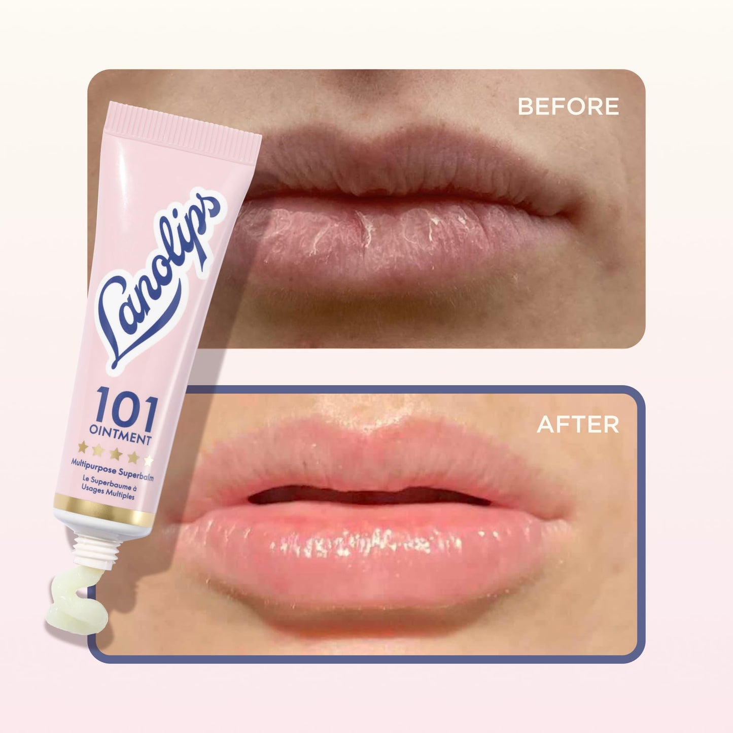 Lanolin 101 Multipurpose Ointment - Lanolin Lip Balm & Healing Ointment for Skin Barrier Repair - Moisturizer for Dry Lips, Cuticles & Elbows - No Petroleum Formula - Original Superbalm (0.52 oz)