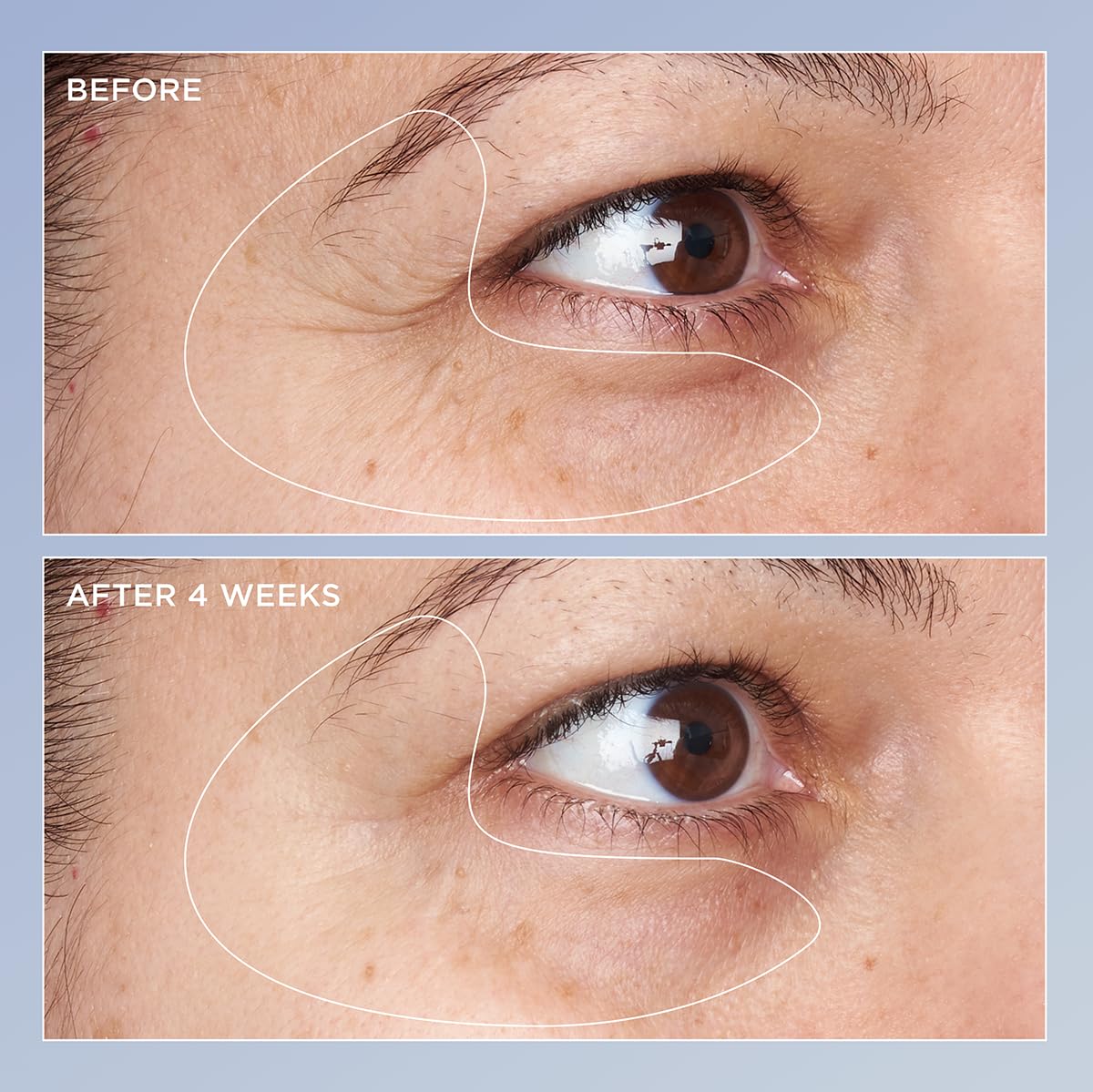 Perricone MD High Potency Triple Retinol Renewal Eye Serum, 0.5 fl. oz.