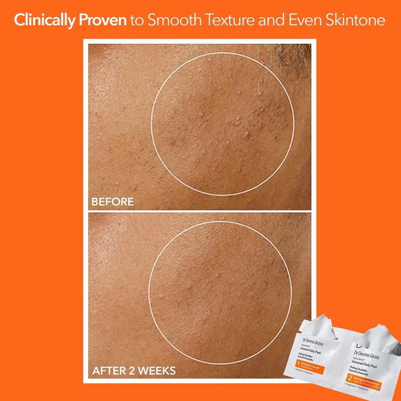 Dr Dennis Gross Alpha Beta Universal Daily Peel, As shown in the image, 30 Count