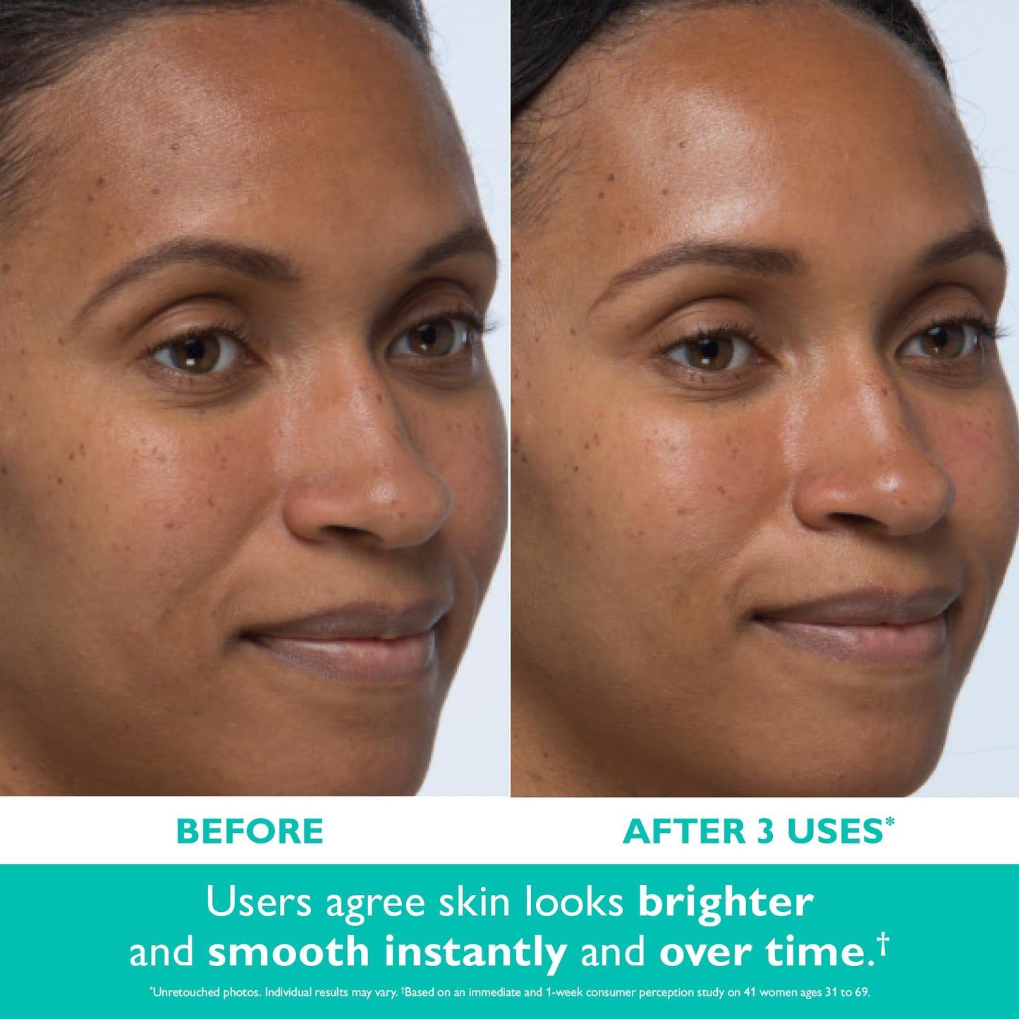 Peter Thomas Roth | Even Smoother™ Instant Reveal Facial Peel | Exfoliator with Glycolic Acid for Brightening