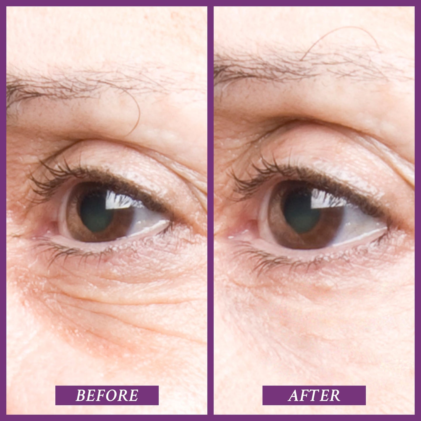 PRAI Beauty Ageless Eye Tight Uplift Serum, Anti-Aging and Hydrating Eye Serum, For Instantly Ageless Brow and Eyelid Area, 0.5 Oz