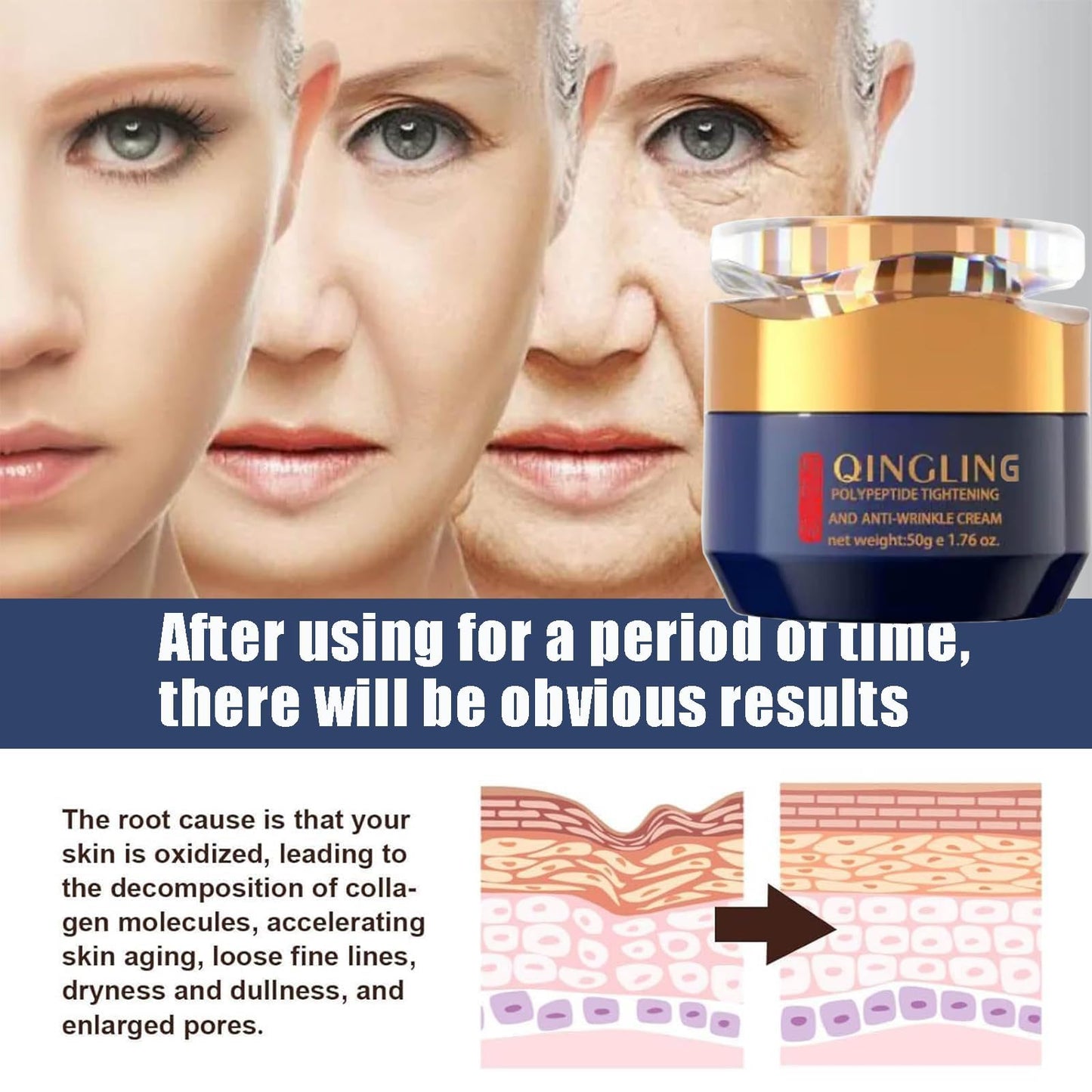 Plutarn Qingling Crema Para Arrugas, Qingling Face Cream, Qingling Wrinkle Removal Cream, Polypeptide Tightening and Anti Wrinkle Cream, Anti Aging Moisturizer for Firming Face (2pcs)