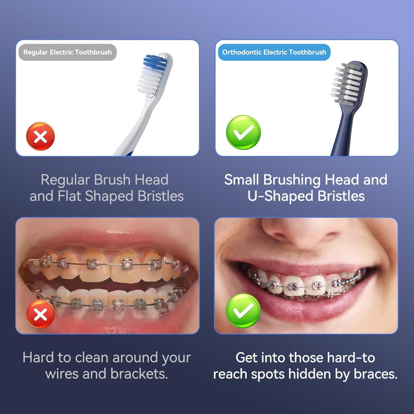 Orthodontic Electric Toothbrush for Braces - 6 U-Shaped Brush Heads, 5 Modes, IPX7 Waterproof | Rechargeable Sonic Clean