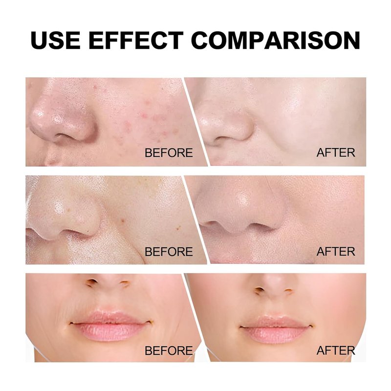 Gentle Nourishing Skincare Set - 8-Piece Complete Routine for All Skin Types | Cleanser, Toner, Serum & More
