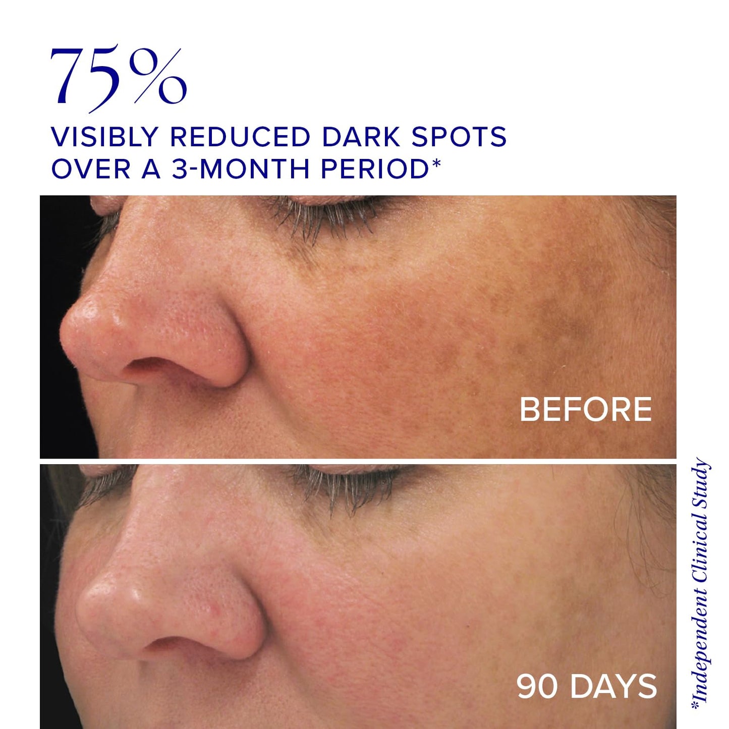 iS CLINICAL Brightening Complex, Skin Brightening Complex, Addresses Age Spots