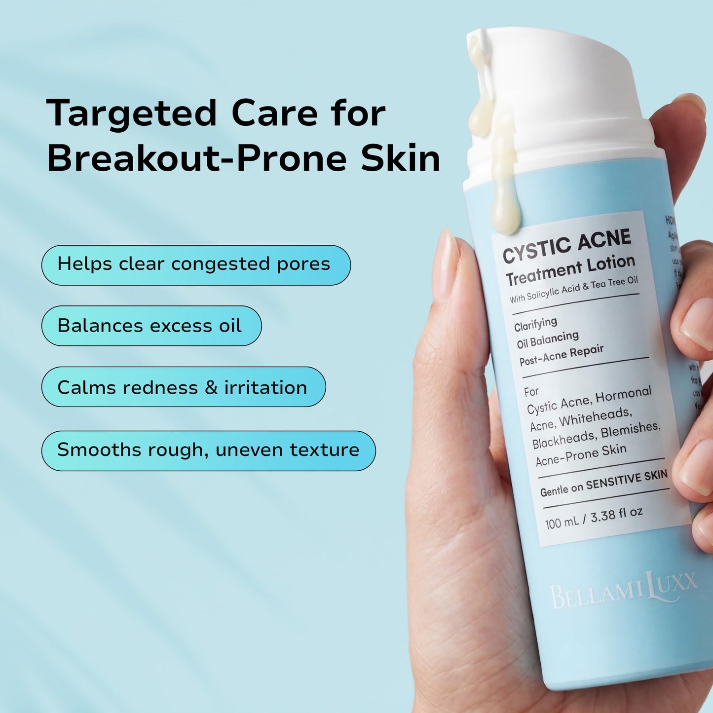 BellamiLuxx Cystic Acne Treatment for Face: Hormonal Acne Treatment Cream for Teens & Adults - Salicylic Acid & Tea Tree Oil Pimple Spot Remover - Anti-Acne Moisturizer Reduces Redness, Blemishes