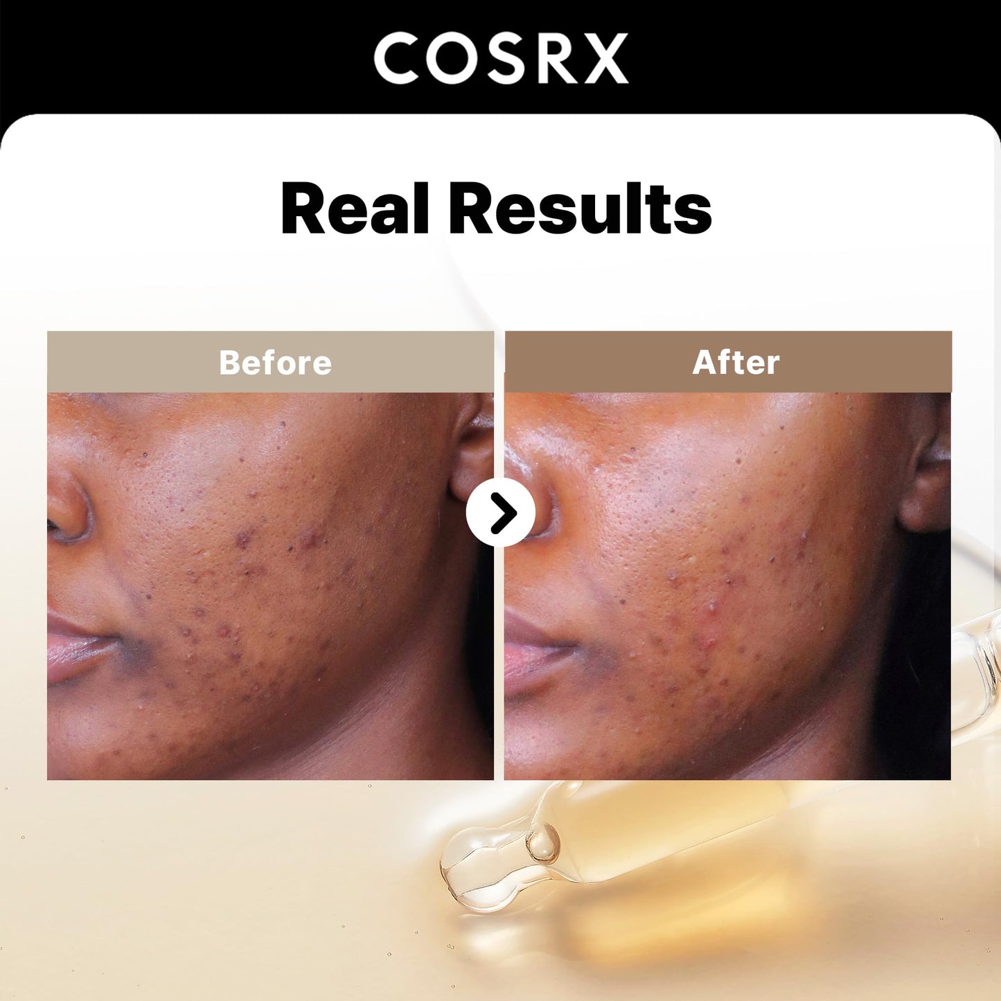 COSRX 2% Alpha Arbutin Discoloration Care Serum + Advanced Snail Mucin Glass Glow Hydrogel Masks
