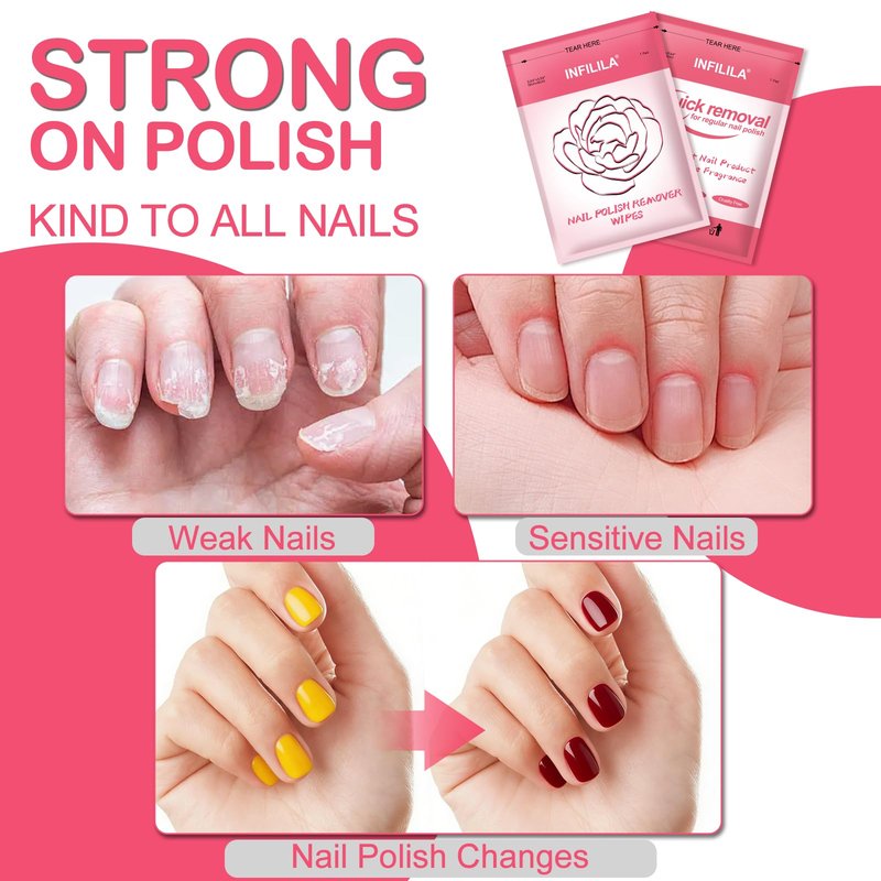 NXJ INFILILA Upgraded Nail Polish Remover Pads - Jumbo Size 50 PCS Acetone Pads with Rose Oil & Aloe Vera, Individually Sealed, Travel-Friendly, Lint-Free, for Regular Polish, Home & Salon Use