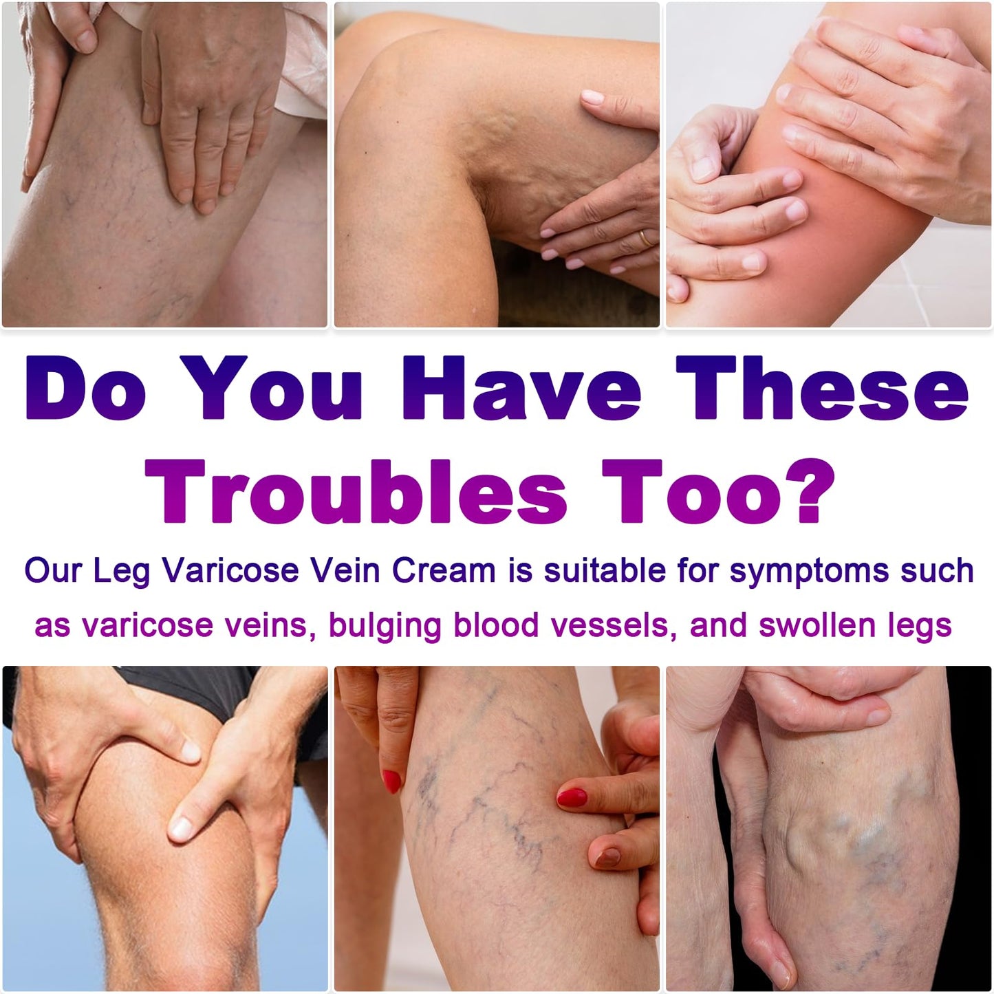 Yongsenina Varicose Veins Cream, Vein Cream & Spider Veins Treatment for Legs, Improves Blood Circulation and Relief From Heavy Fatigued Leg, Refreshing and Non-Sticky, 2PK