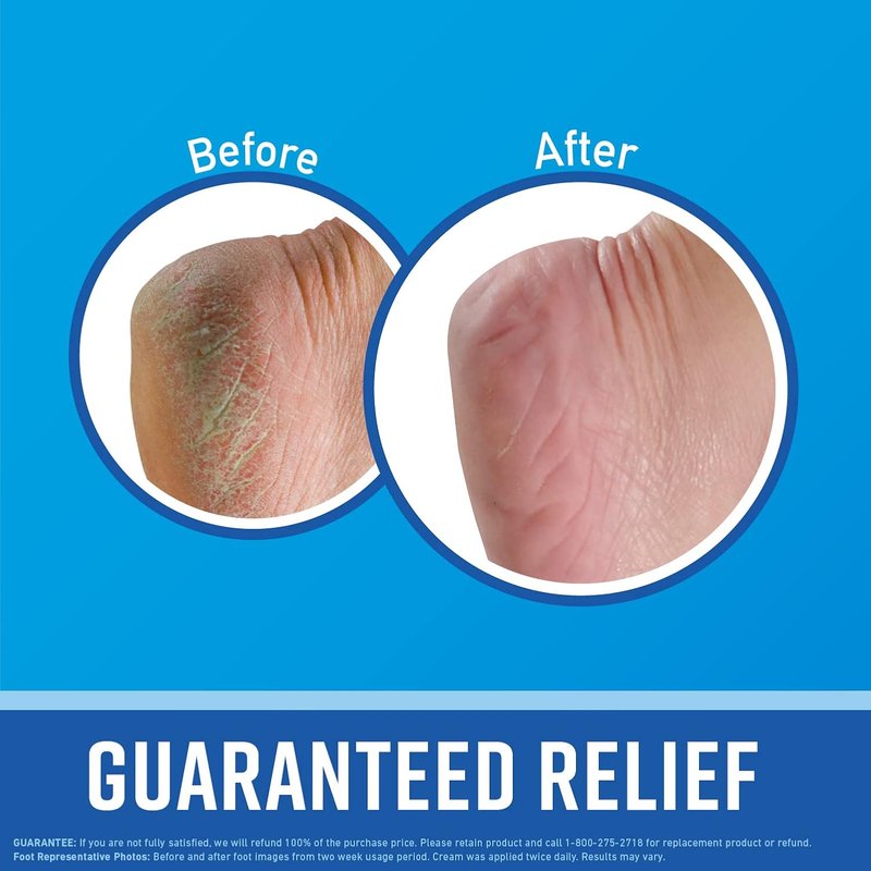 O'Keeffe's Lip Repair Night Treatment Balm - Moisturizing Formula for Soft Lips | 0.25 oz Jar & O'Keeffe's Healthy Feet Foot Cream - Intensive Hydration | 3.2 oz Jar