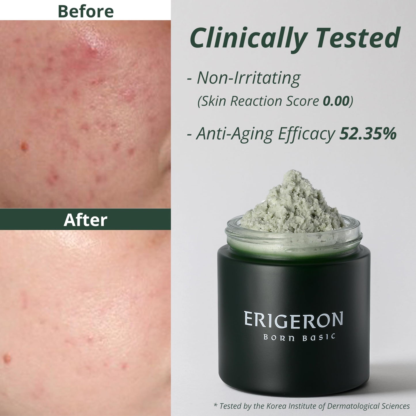 ERIGERON Heartleaf Facial Cleanser, Face Mask, Greek Yogurt Cleanser, Soothing, Deep Pore Scrubber & Face Wash with Green Tea, Blackhead Remover, Korean Skin Care (3.38 fl.oz.)