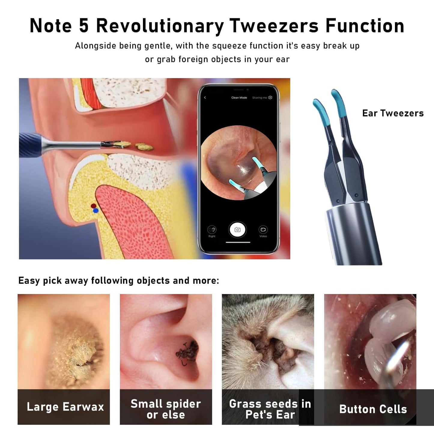 KWYBOW Note5 Ear Wax Tweezers with Camera, 10MP Ear Cleaner Camera Otoscope with Light,Real-time Remote Video with Ear Pick & Tweezers,12 Pcs Ear Scoops for Whole Family