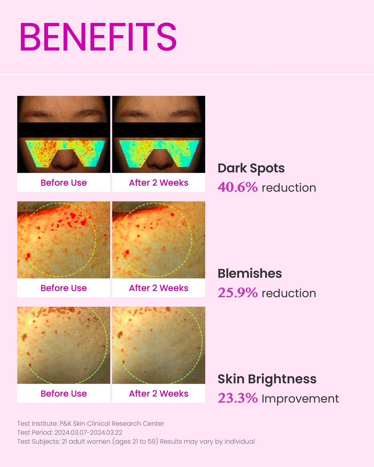 DOMINAS AtClinic TXA Spot Shot Serum - Dark Spot Corrector with Tranexamic Acid, 4% Niacinamide and Pink Vitamin B12, Hyperpigmentation, Uneven Skin Tone & Blemish Care, Korean Skincare, 1.01 fl oz